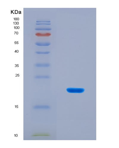 SDS-PAGE analysis of Human MTOR (Serine/Threonine-Protein Kinase Mtor) - Recombinant Protein, CAT# BLT-08830P showing >90% purity under 15% SDS-PAGE (Reduced)Human MTOR (Serine/Threonine-Protein Kinase Mtor) - Recombinant Protein