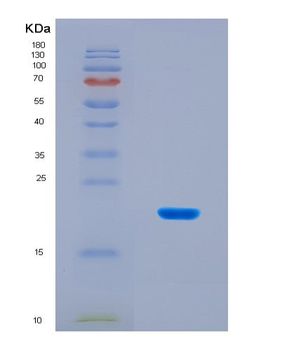 SDS-PAGE analysis of Human MTOR (Serine/Threonine-Protein Kinase Mtor) - Recombinant Protein, CATHuman MTOR (Serine/Threonine-Protein Kinase Mtor) - Recombinant Protein