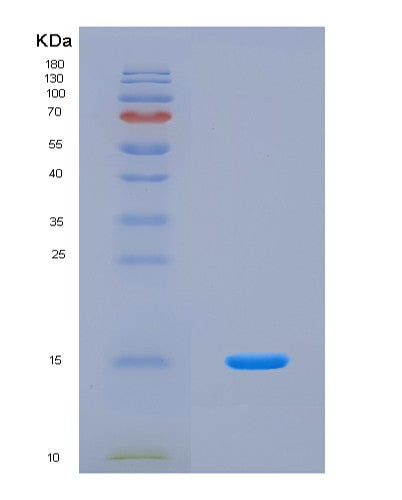 SDS-PAGE analysis of Human MTOR (Serine/Threonine-Protein Kinase Mtor) - Recombinant Protein, CATHuman MTOR (Serine/Threonine-Protein Kinase Mtor) - Recombinant Protein