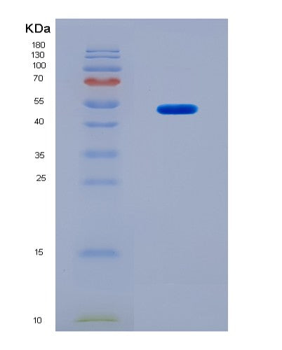 SDS-PAGE analysis of Human CSK (Tyrosine-Protein Kinase Csk) - Recombinant Protein, CATHuman CSK (Tyrosine-Protein Kinase Csk) - Recombinant Protein