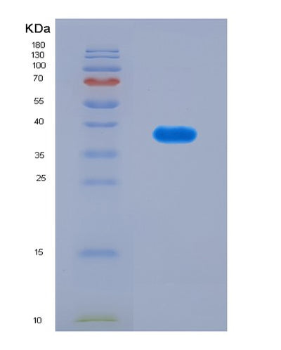 SDS-PAGE analysis of Human AARS2 (Alanine--Trna Ligase, Mitochondrial) - Recombinant Protein, CAT# BLT-08833P showing >90% purity under 15% SDS-PAGE (Reduced)Human AARS2 (Alanine--Trna Ligase, Mitochondrial) - Recombinant Protein