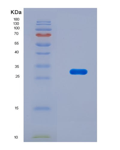SDS-PAGE analysis of Mouse Ripk3 (Receptor-Interacting Serine/Threonine-Protein Kinase 3) - Recombinant Protein, CAT# BLT-08834P showing >90% purity under 15% SDS-PAGE (Reduced)Mouse Ripk3 (Receptor-Interacting Serine/Threonine-Protein Kinase 3) - Recombinant Protein