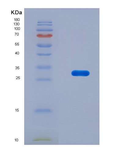 SDS-PAGE analysis of Mouse Ripk3 (Receptor-Interacting Serine/Threonine-Protein Kinase 3) - Recombinant Protein, CATMouse Ripk3 (Receptor-Interacting Serine/Threonine-Protein Kinase 3) - Recombinant Protein