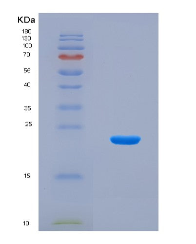 SDS-PAGE analysis of Human RAB1B (Ras-Related Protein Rab-1B) - Recombinant Protein, CATHuman RAB1B (Ras-Related Protein Rab-1B) - Recombinant Protein