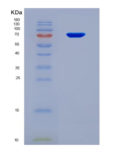 SDS-PAGE analysis of Human ATP2A2 (Sarcoplasmic/Endoplasmic Reticulum Calcium Atpase 2) - Recombinant Protein, CAT# BLT-08836P showing >90% purity under 15% SDS-PAGE (Reduced)Human ATP2A2 (Sarcoplasmic/Endoplasmic Reticulum Calcium Atpase 2) - Recombinant Protein