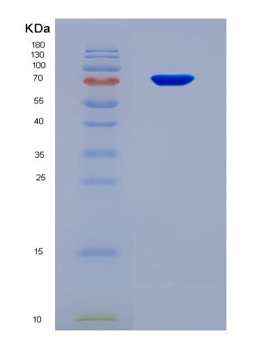 SDS-PAGE analysis of Human ATP2A2 (Sarcoplasmic/Endoplasmic Reticulum Calcium Atpase 2) - Recombinant Protein, CATHuman ATP2A2 (Sarcoplasmic/Endoplasmic Reticulum Calcium Atpase 2) - Recombinant Protein