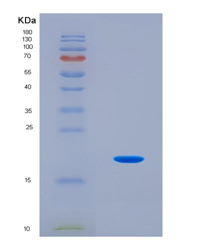 SDS-PAGE analysis of Human NOS3 (Nitric Oxide Synthase 3) - Recombinant Protein, CATHuman NOS3 (Nitric Oxide Synthase 3) - Recombinant Protein