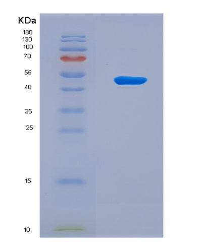 SDS-PAGE analysis of Human OLIG2 (Oligodendrocyte Transcription Factor 2) - Recombinant Protein, CAT# BLT-08839P showing >90% purity under 15% SDS-PAGE (Reduced)Human OLIG2 (Oligodendrocyte Transcription Factor 2) - Recombinant Protein
