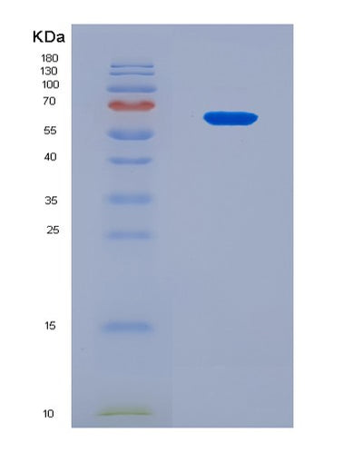 SDS-PAGE analysis of Human DDX6 (Probable Atp-Dependent Rna Helicase Ddx6) - Recombinant Protein, CAT# BLT-08840P showing >90% purity under 15% SDS-PAGE (Reduced)Human DDX6 (Probable Atp-Dependent Rna Helicase Ddx6) - Recombinant Protein