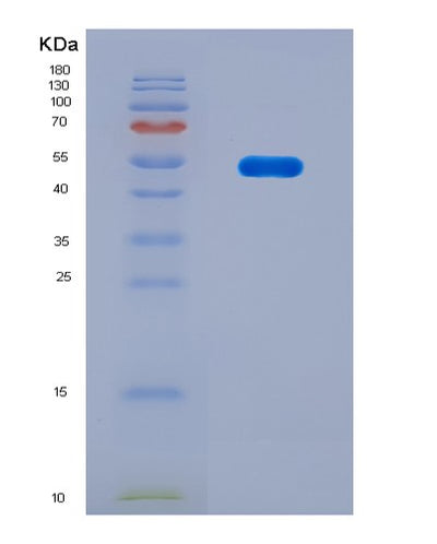 SDS-PAGE analysis of Mouse Ctsk (Cathepsin K) - Recombinant Protein, CAT# BLT-08842P showing >90% purity under 15% SDS-PAGE (Reduced)Mouse Ctsk (Cathepsin K) - Recombinant Protein
