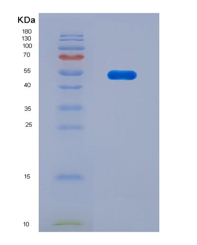 SDS-PAGE analysis of Mouse Ctsk (Cathepsin K) - Recombinant Protein, CATMouse Ctsk (Cathepsin K) - Recombinant Protein
