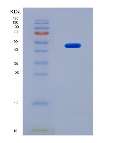 SDS-PAGE analysis of Human HNRNPA2B1 (Heterogeneous Nuclear Ribonucleoproteins A2/B1) - Recombinant Protein, CATHuman HNRNPA2B1 (Heterogeneous Nuclear Ribonucleoproteins A2/B1) - Recombinant Protein