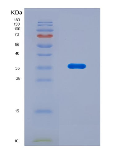 SDS-PAGE analysis of Human Optic Atrophy 1, Autosomal Dominant (OPA1) - Recombinant Protein, CAT# BLT-08848P showing >90% purity under 15% SDS-PAGE (Reduced)Human Optic Atrophy 1, Autosomal Dominant (OPA1) - Recombinant Protein