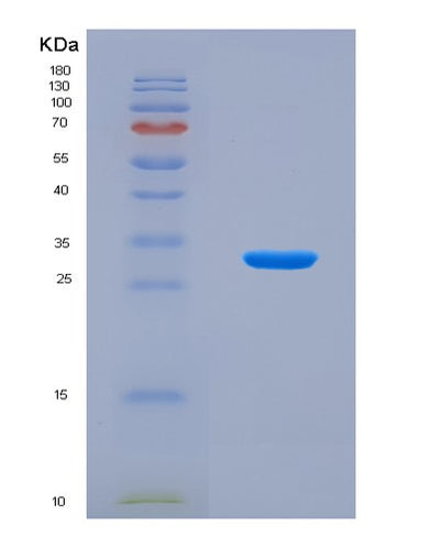 SDS-PAGE analysis of Human MATK (Megakaryocyte-Associated Tyrosine-Protein Kinase) - Recombinant Protein, CAT# BLT-08850P showing >90% purity under 15% SDS-PAGE (Reduced)Human MATK (Megakaryocyte-Associated Tyrosine-Protein Kinase) - Recombinant Protein