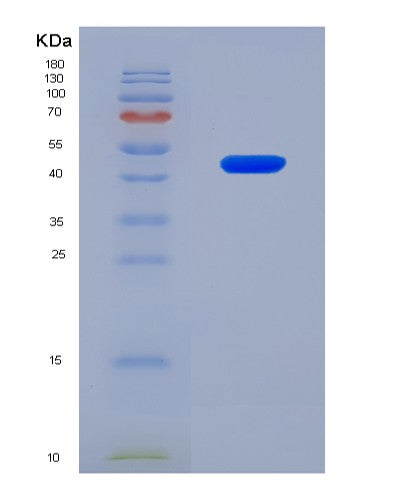 SDS-PAGE analysis of Human COL5A2 (Collagen Alpha-2(V) Chain) - Recombinant Protein, CATHuman COL5A2 (Collagen Alpha-2(V) Chain) - Recombinant Protein