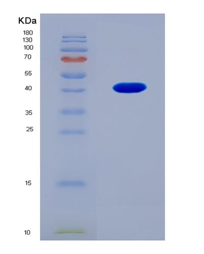 SDS-PAGE analysis of Human COL5A2 (Collagen Alpha-2(V) Chain) - Recombinant Protein, CAT# BLT-08857P showing >90% purity under 15% SDS-PAGE (Reduced)Human COL5A2 (Collagen Alpha-2(V) Chain) - Recombinant Protein