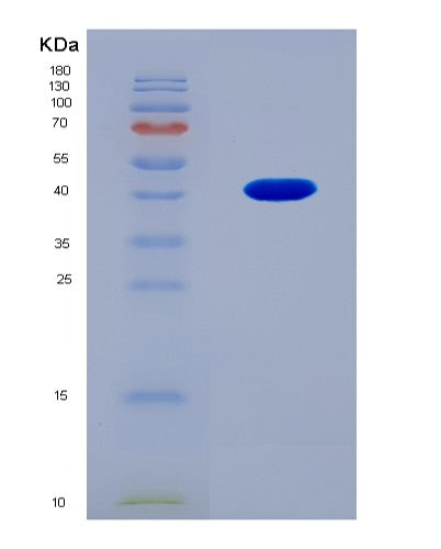 SDS-PAGE analysis of Human COL5A2 (Collagen Alpha-2(V) Chain) - Recombinant Protein, CATHuman COL5A2 (Collagen Alpha-2(V) Chain) - Recombinant Protein