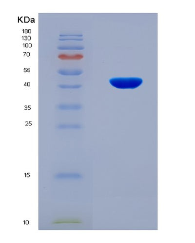 SDS-PAGE analysis of Human COL5A2 (Collagen Alpha-2(V) Chain) - Recombinant Protein, CAT# BLT-08858P showing >90% purity under 15% SDS-PAGE (Reduced)Human COL5A2 (Collagen Alpha-2(V) Chain) - Recombinant Protein