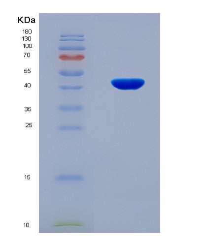 SDS-PAGE analysis of Human COL5A2 (Collagen Alpha-2(V) Chain) - Recombinant Protein, CATHuman COL5A2 (Collagen Alpha-2(V) Chain) - Recombinant Protein