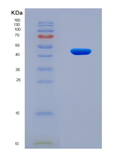 SDS-PAGE analysis of Human COL5A2 (Collagen Alpha-2(V) Chain) - Recombinant Protein, CATHuman COL5A2 (Collagen Alpha-2(V) Chain) - Recombinant Protein