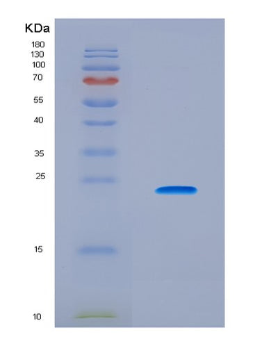 SDS-PAGE analysis of Human CTCF (Transcriptional Repressor Ctcf) - Recombinant Protein, CAT# BLT-08860P showing >90% purity under 15% SDS-PAGE (Reduced)Human CTCF (Transcriptional Repressor Ctcf) - Recombinant Protein