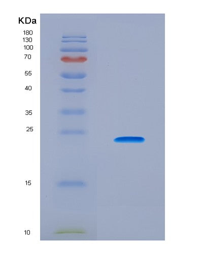 SDS-PAGE analysis of Human CTCF (Transcriptional Repressor Ctcf) - Recombinant Protein, CATHuman CTCF (Transcriptional Repressor Ctcf) - Recombinant Protein