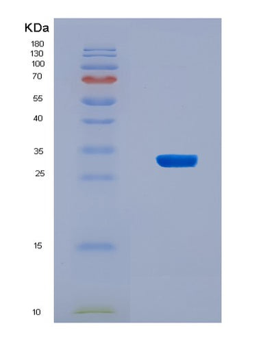SDS-PAGE analysis of Human FMO3 (Flavin-Containing Monooxygenase 3) - Recombinant Protein, CAT# BLT-08863P showing >90% purity under 15% SDS-PAGE (Reduced)Human FMO3 (Flavin-Containing Monooxygenase 3) - Recombinant Protein
