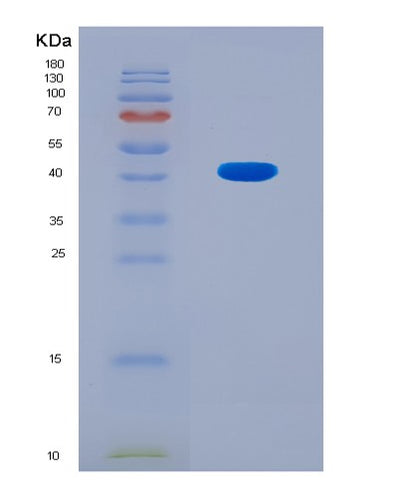 SDS-PAGE analysis of Mouse Cd3e (T-Cell Surface Glycoprotein Cd3 Epsilon Chain) - Recombinant Protein, CAT# BLT-08864P showing >90% purity under 15% SDS-PAGE (Reduced)Mouse Cd3e (T-Cell Surface Glycoprotein Cd3 Epsilon Chain) - Recombinant Protein