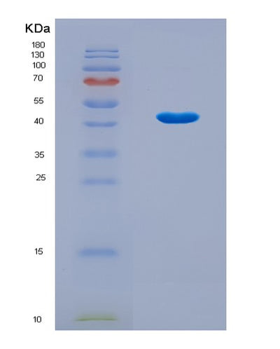 SDS-PAGE analysis of Human SKP2 (S-Phase Kinase-Associated Protein 2) - Recombinant Protein, CAT# BLT-08865P showing >90% purity under 15% SDS-PAGE (Reduced)Human SKP2 (S-Phase Kinase-Associated Protein 2) - Recombinant Protein