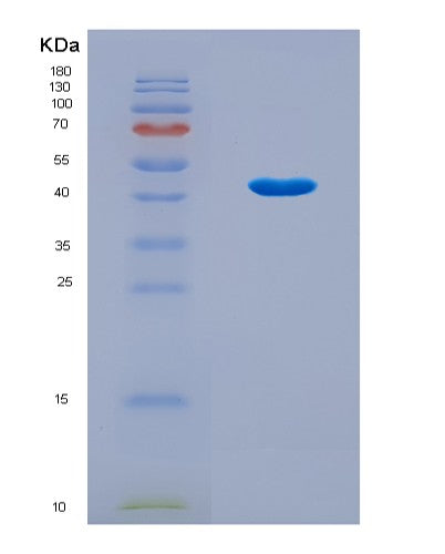 SDS-PAGE analysis of Human SKP2 (S-Phase Kinase-Associated Protein 2) - Recombinant Protein, CATHuman SKP2 (S-Phase Kinase-Associated Protein 2) - Recombinant Protein