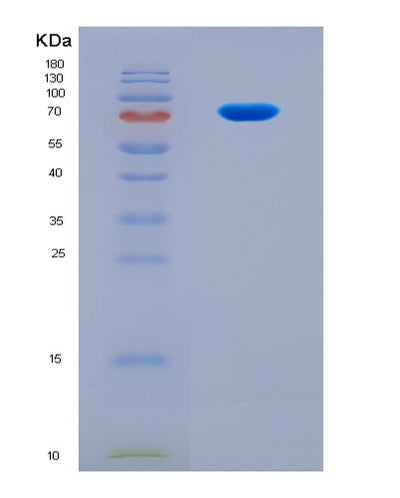 SDS-PAGE analysis of Human IFIT3 (Interferon-Induced Protein With Tetratricopeptide Repeats 3) - Recombinant Protein, CAT# BLT-08867P showing >90% purity under 15% SDS-PAGE (Reduced)Human IFIT3 (Interferon-Induced Protein With Tetratricopeptide Repeats 3) - Recombinant Protein