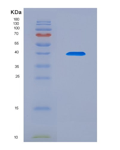 SDS-PAGE analysis of Human TIMD4 (T-Cell Immunoglobulin And Mucin Domain-Containing Protein 4) - Recombinant Protein, CATHuman TIMD4 (T-Cell Immunoglobulin And Mucin Domain-Containing Protein 4) - Recombinant Protein