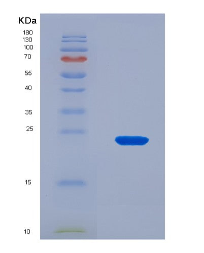 SDS-PAGE analysis of Human P2RY12 (P2Y Purinoceptor 12) - Recombinant Protein, CATHuman P2RY12 (P2Y Purinoceptor 12) - Recombinant Protein
