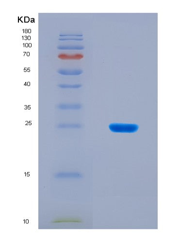 SDS-PAGE analysis of Human PTGIR (Prostacyclin Receptor) - Recombinant Protein, CATHuman PTGIR (Prostacyclin Receptor) - Recombinant Protein