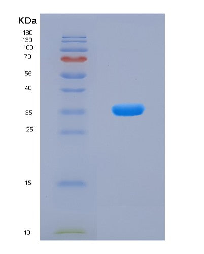 SDS-PAGE analysis of Human ITGB3 (Integrin Beta-3) - Recombinant Protein, CATHuman ITGB3 (Integrin Beta-3) - Recombinant Protein
