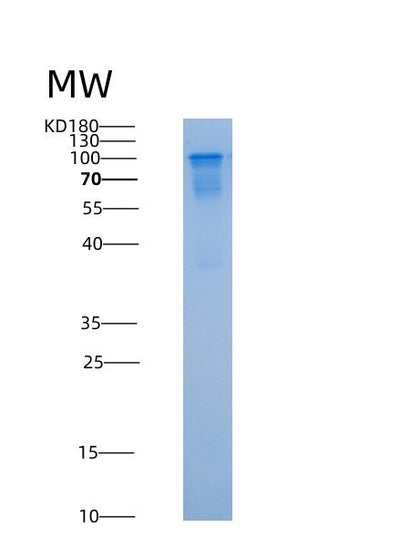 SDS-PAGE analysis of Human NSD3 (Histone-Lysine N-Methyltransferase Nsd3) - Recombinant Protein, CAT# BLT-08872P showing >85% purity under 15% SDS-PAGE (Reduced)Human NSD3 (Histone-Lysine N-Methyltransferase Nsd3) - Recombinant Protein