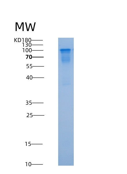 SDS-PAGE analysis of Human NSD3 (Histone-Lysine N-Methyltransferase Nsd3) - Recombinant Protein, CATHuman NSD3 (Histone-Lysine N-Methyltransferase Nsd3) - Recombinant Protein