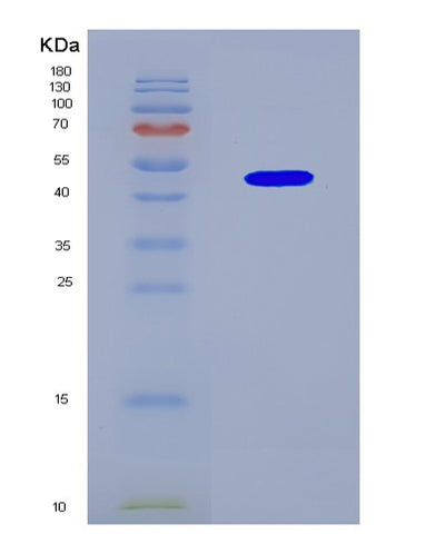 SDS-PAGE analysis of Human SHFL (Shiftless Antiviral Inhibitor Of Ribosomal Frameshifting Protein) - Recombinant Protein, CAT# BLT-08873P showing >85% purity under 15% SDS-PAGE (Reduced)Human SHFL (Shiftless Antiviral Inhibitor Of Ribosomal Frameshifting Protein) - Recombinant Protein