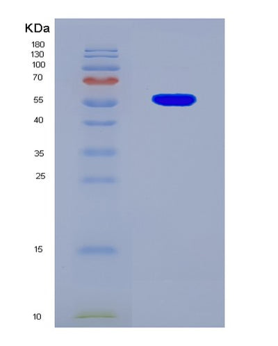 SDS-PAGE analysis of Human PTPA (Serine/Threonine-Protein Phosphatase 2A Activator) - Recombinant Protein, CAT# BLT-08874P showing >85% purity under 15% SDS-PAGE (Reduced)Human PTPA (Serine/Threonine-Protein Phosphatase 2A Activator) - Recombinant Protein