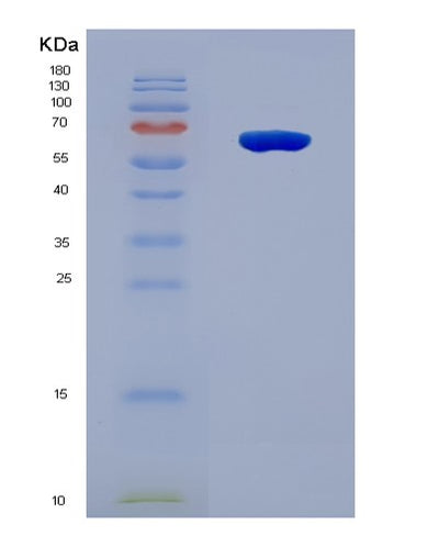 SDS-PAGE analysis of Human DDX56 (Probable Atp-Dependent Rna Helicase Ddx56) - Recombinant Protein, CAT# BLT-08875P showing >90% purity under 15% SDS-PAGE (Reduced)Human DDX56 (Probable Atp-Dependent Rna Helicase Ddx56) - Recombinant Protein