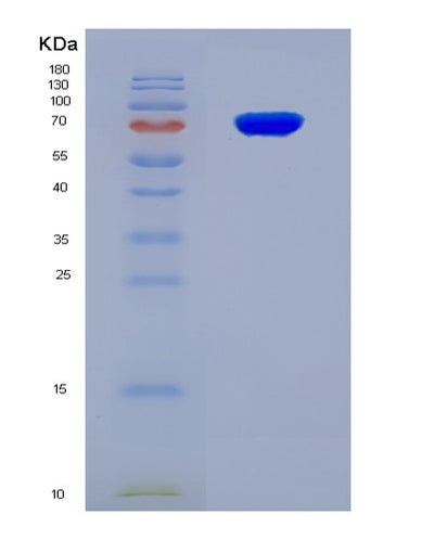 SDS-PAGE analysis of Human FMO3 (Flavin-Containing Monooxygenase 3) - Recombinant Protein, CAT# BLT-08876P showing >85% purity under 15% SDS-PAGE (Reduced)Human FMO3 (Flavin-Containing Monooxygenase 3) - Recombinant Protein
