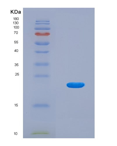 SDS-PAGE analysis of Human GPBAR1 (G-Protein Coupled Bile Acid Receptor 1) - Recombinant Protein, CATHuman GPBAR1 (G-Protein Coupled Bile Acid Receptor 1) - Recombinant Protein