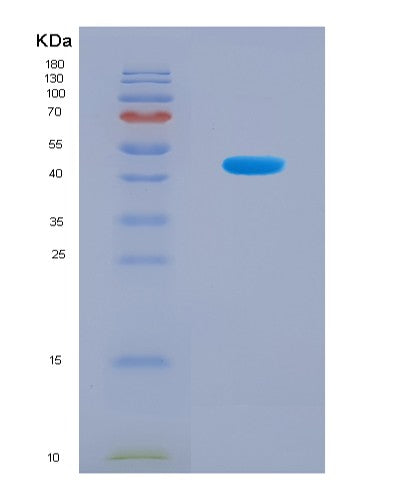 SDS-PAGE analysis of Human KRT17 (Keratin, Type I Cytoskeletal 17) - Recombinant Protein, CATHuman KRT17 (Keratin, Type I Cytoskeletal 17) - Recombinant Protein