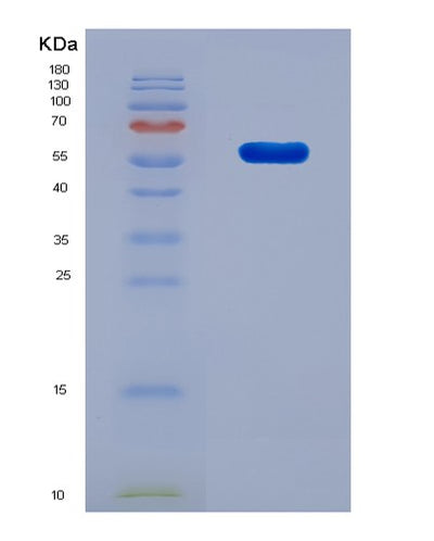 SDS-PAGE analysis of Human (Line-1 Retrotransposable Element Orf2 Protein) - Recombinant Protein, CAT# BLT-08739P showing >90% purity under 15% SDS-PAGE (Reduced)Human (Line-1 Retrotransposable Element Orf2 Protein) - Recombinant Protein