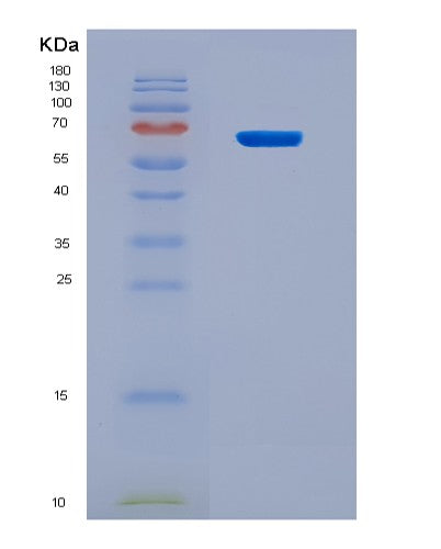 SDS-PAGE analysis of Human NR2E1 (Nuclear Receptor Subfamily 2 Group E Member 1) - Recombinant Protein, CATHuman NR2E1 (Nuclear Receptor Subfamily 2 Group E Member 1) - Recombinant Protein