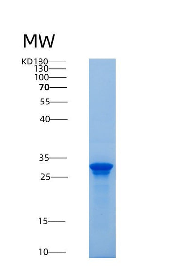 SDS-PAGE analysis of Mouse Saa3 (Serum Amyloid A-3 Protein) - Recombinant Protein, CAT# BLT-08880P showing >85% purity under 15% SDS-PAGE (Reduced)Mouse Saa3 (Serum Amyloid A-3 Protein) - Recombinant Protein