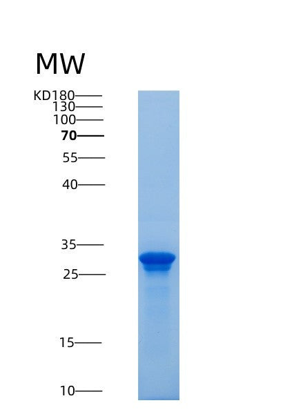 SDS-PAGE analysis of Mouse Saa3 (Serum Amyloid A-3 Protein) - Recombinant Protein, CATMouse Saa3 (Serum Amyloid A-3 Protein) - Recombinant Protein