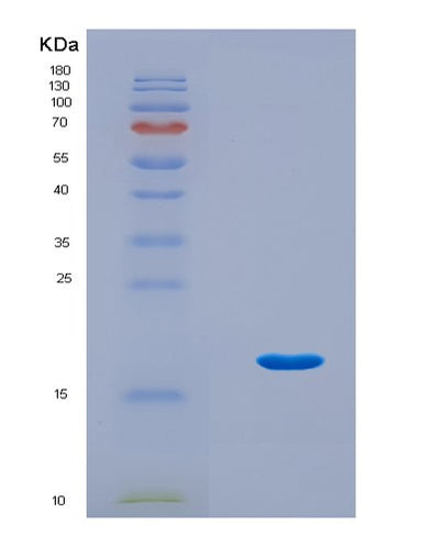 SDS-PAGE analysis of Mouse Col3a1 (Collagen Alpha-1(Iii) Chain) - Recombinant Protein, CAT# BLT-08882P showing >90% purity under 15% SDS-PAGE (Reduced)Mouse Col3a1 (Collagen Alpha-1(Iii) Chain) - Recombinant Protein