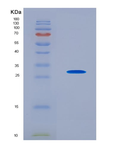 SDS-PAGE analysis of Human COL1A1 (Collagen Alpha-1(I) Chain) - Recombinant Protein, CAT# BLT-08881P showing >90% purity under 15% SDS-PAGE (Reduced)Human COL1A1 (Collagen Alpha-1(I) Chain) - Recombinant Protein