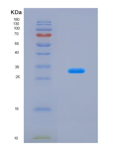 SDS-PAGE analysis of Mouse Lgr5 (Leucine-Rich Repeat-Containing G-Protein Coupled Receptor 5) - Recombinant Protein, CATMouse Lgr5 (Leucine-Rich Repeat-Containing G-Protein Coupled Receptor 5) - Recombinant Protein